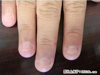 剪指甲、挖耳屎,这些日常小动作竟隐藏大危害! - 眉山生活资讯 - 眉山28生活网 ms.28life.com
